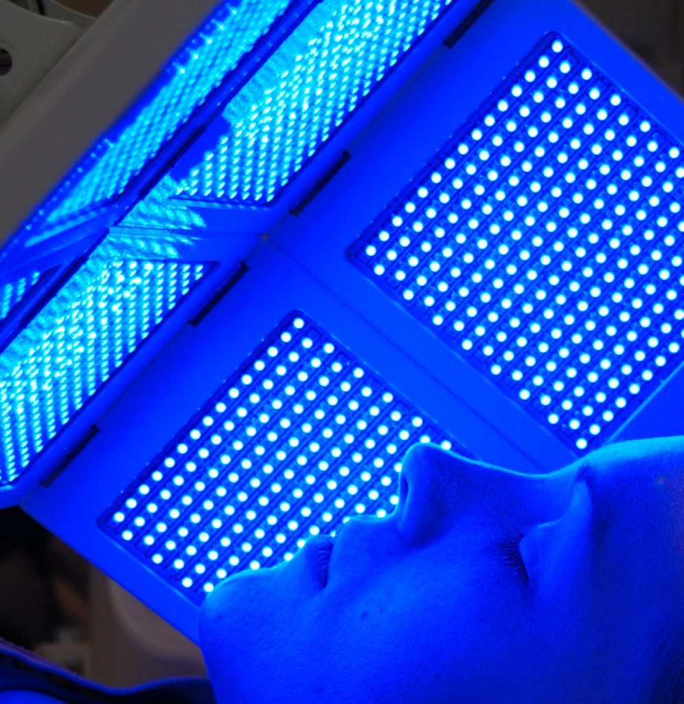 Picture of woman layiong under blue LED light therapy