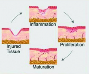 skin injury and inflammation