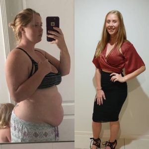 Injection weight loss in Washington DC